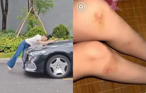 ▲蘇洛洛拍短劇車禍戲被撞飛，本人親曬出腿部的瘀青。（圖／翻攝自微博@少許淚點）
