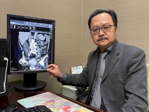 無痛性血尿別輕忽　醫示警：全台膀胱癌年增3千例