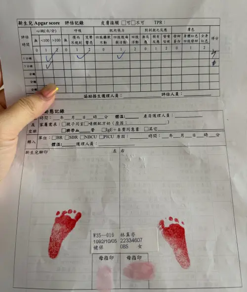 ▲林真亦PO出超音波照以及寶寶的腳印照，難過地向寶寶喊話，「祢的腳印媽媽留著，好讓祢記得回來的路怎麼走，等祢下次再回來找我們的時候，行李記得要帶好。」（圖／林真亦臉書）