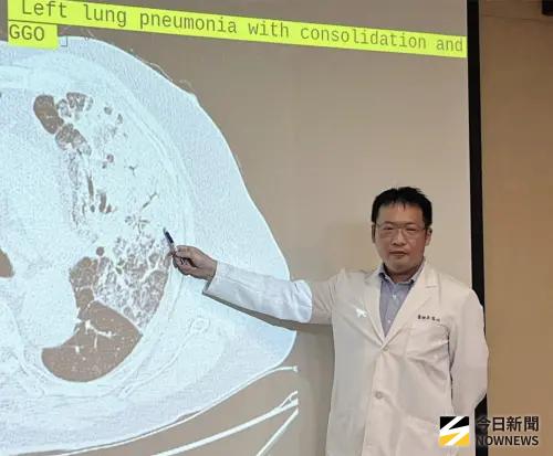 男全身無力、肺炎！找不出致病菌　三總檢測揪出「退伍軍人菌」

