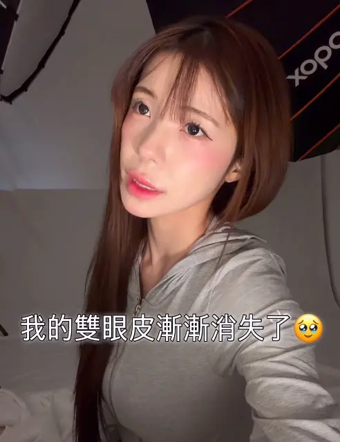▲李多慧無奈表示雙眼皮漸漸消失，還喊話粉絲幫她決定要不要割雙眼皮。（圖／翻攝自李多慧IG@82dahyeday）