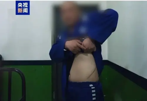 詐騙園區「真會割腰子」？緬甸豬仔曝超長傷疤：業績差被摘腎抵債