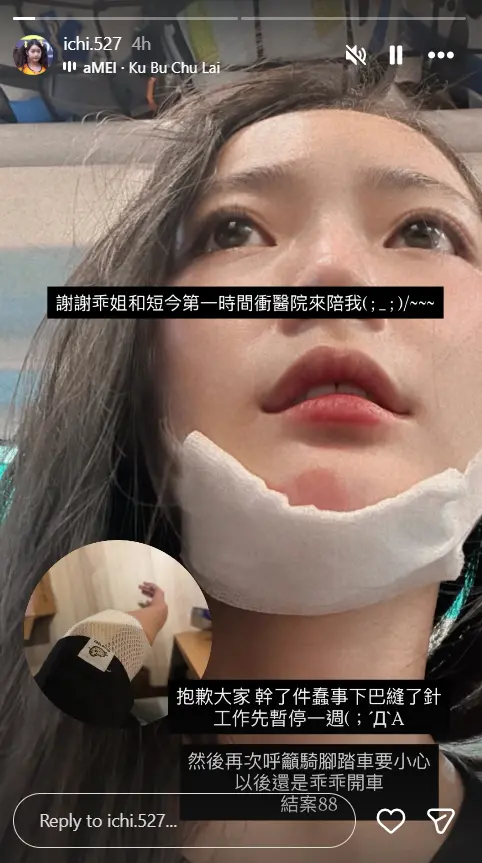 ▲怡琪騎Ubike不小心摔車，導致下巴裂開而縫針，她也宣布即刻停工一個禮拜養傷。（圖／怡琪IG@ichi.527）