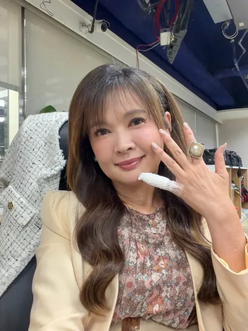 ▲王淑麗上週日主持活動不慎跌了一跤，導致手腳多處擦傷、挫傷，還有腫痛和瘀青。（圖／王淑麗臉書）