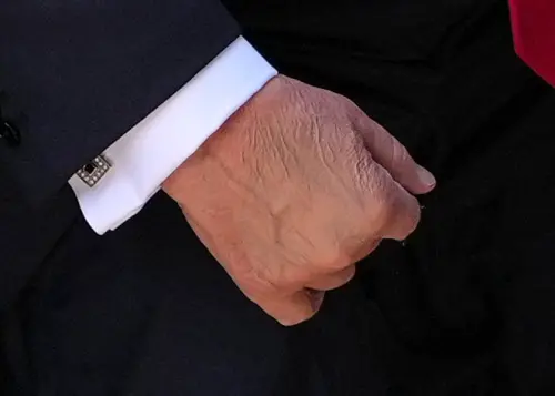 ▲川普過去曾多次被拍到手背出現瘀青。（圖／美聯社／達志影像）