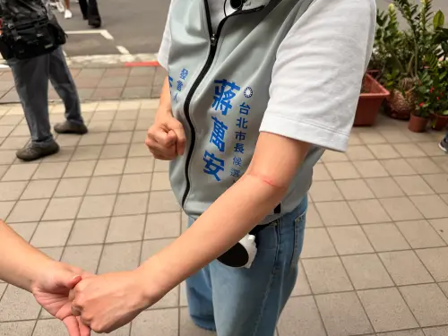 ▲熱情支持者將藍委李彥秀誤認為市長蔣萬安太太石舫亘，不慎將她的左手抓傷。（圖／記者蘇柏銓攝）